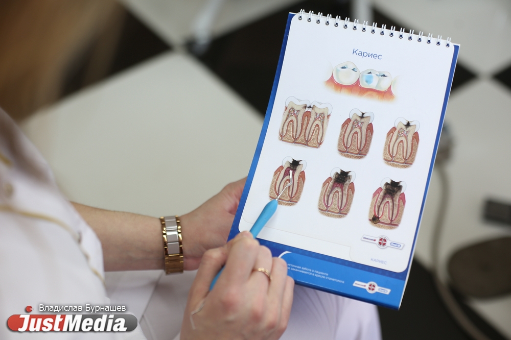 Сверлят здоровые зубы и ставят устаревшие пломбы. JustMedia.Ru узнал, как уральцев обманывают в стоматологиях - Фото 7