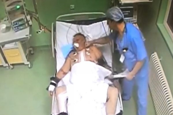 В Перми анестезиолог избил пациента, прикованного к кровати после операции на сердце - Фото 1