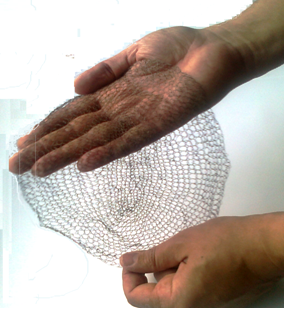 Екатеринбургские инноваторы создали «титановый шелк» для лечения грыж - Фото 2