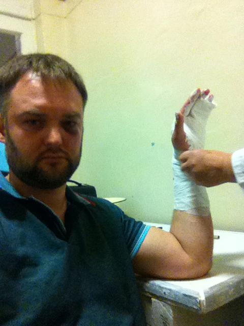 Агрессивные сотрудники автосервиса могут лишить юриста Волкова мандата депутата заксо - Фото 3