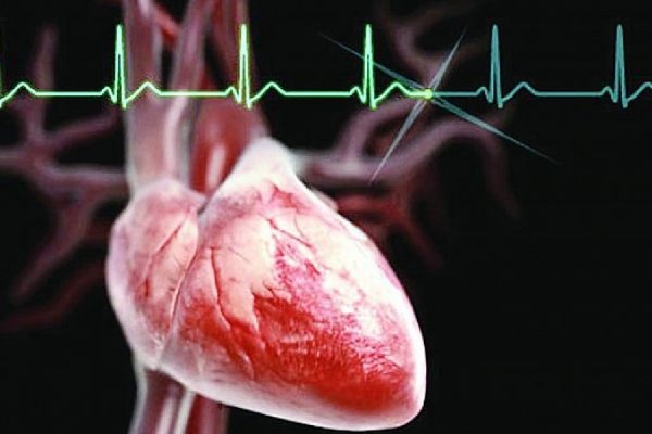 В России появилась компьютерная игра-симулятор для кардиологов - Фото 1