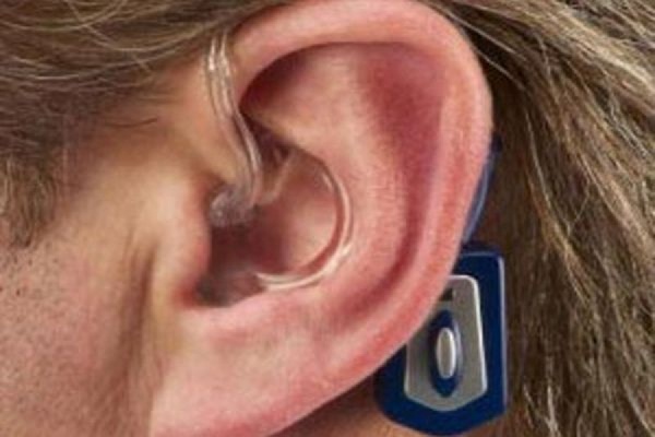 России создают единую систему оповещения экстренных служб для людей с нарушением слуха - Фото 1