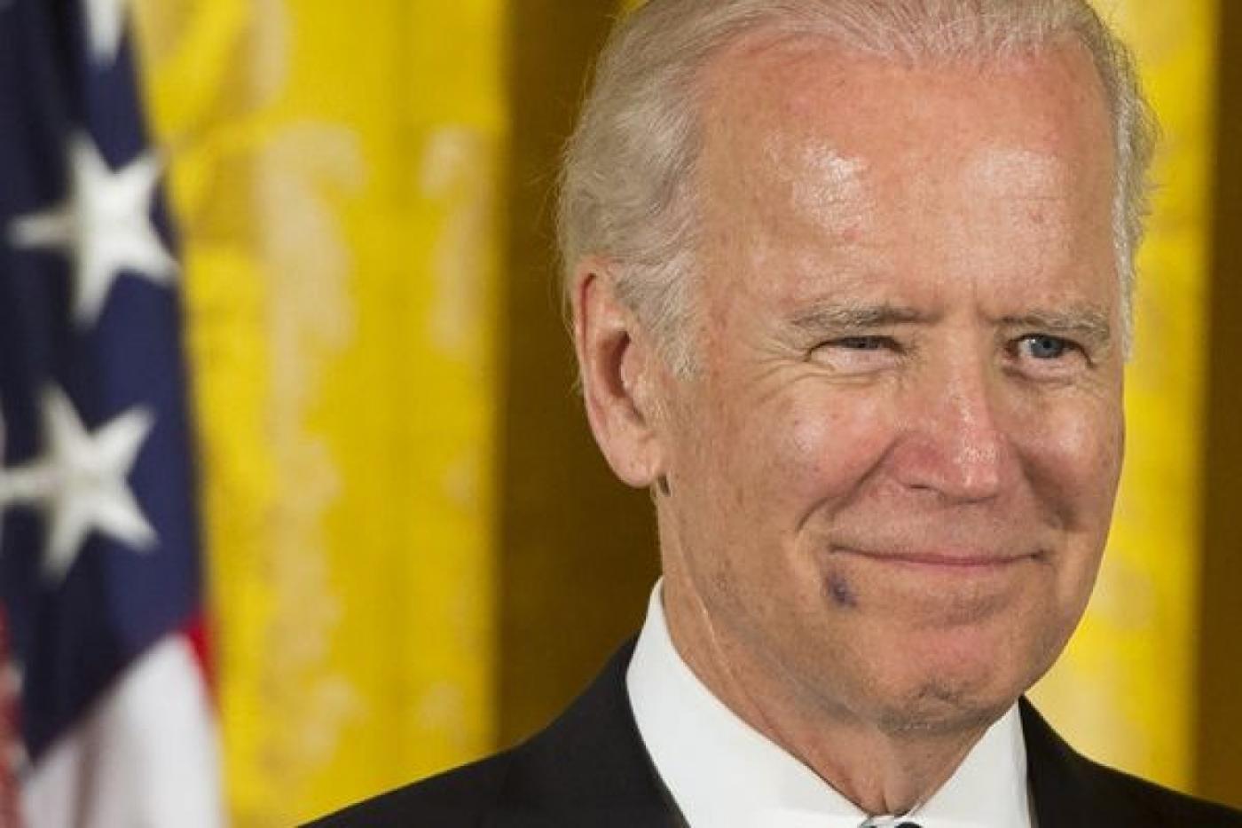 Вице-президент США Джо Байден появился на публике с синяком на лице - Фото 1