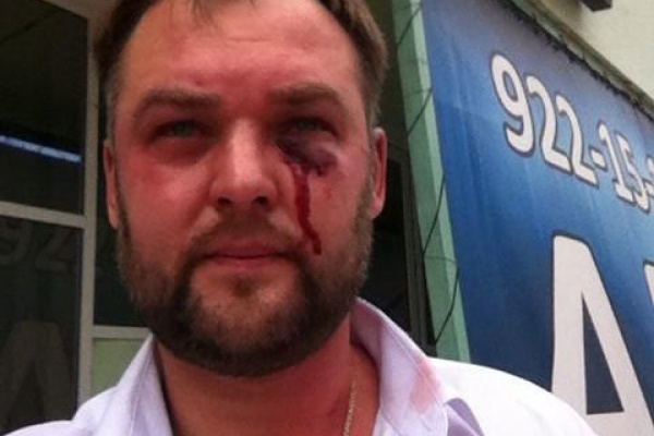 «Директор автосервиса арестован, администратор подался в бега». СК возбудил уголовное дело по нападению на журналистов и кандидата в депутаты