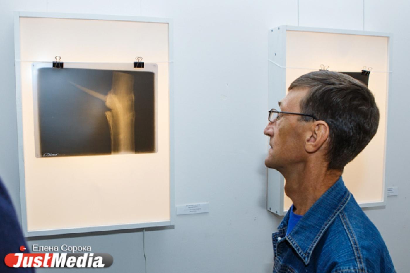 Скандальный художник Василий Слонов обнародовал рентгеновские снимки вымышленных персонажей  - Фото 1