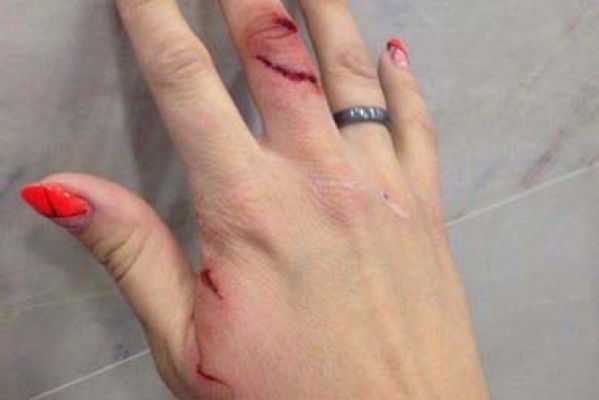 «Решить дело миром не удалось». Пострадавшая от квадрокоптера жительница Екатеринбурга написала заявление в полицию