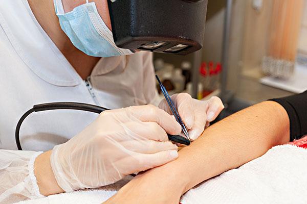 Выясняем, кому подойдет электроэпиляция - Фото 1