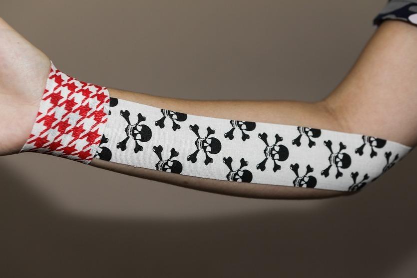 Кинезиотейпирование - что это такое - Фото 1