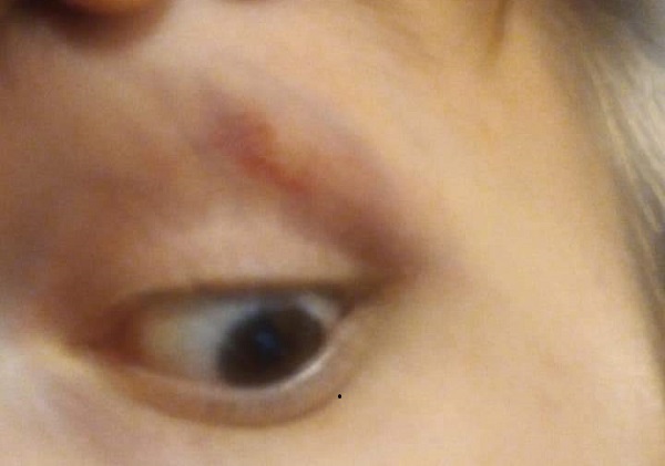 Неизвестные избили агитатора КПРФ  - Фото 1