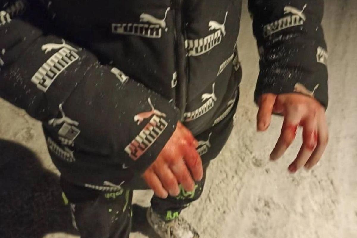 На Урале подросток избил битой троих школьников за то, что они обидели его брата - Фото 1