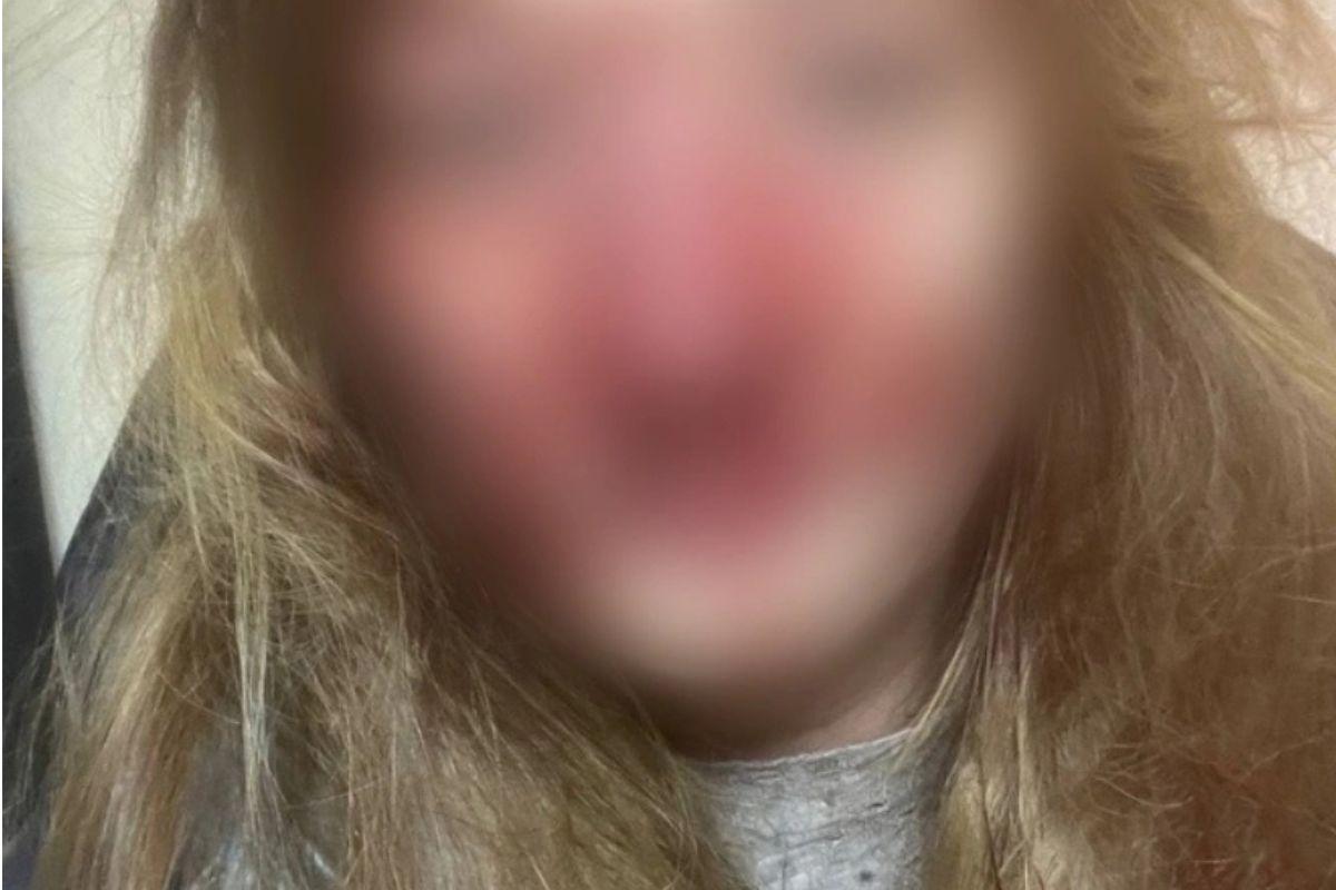 В Академическом две мамы устроили кровавую драку у детсада из-за ссоры в соцсетях - Фото 1