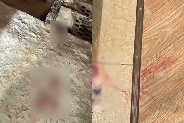 На Урале мужчина по пьяни зарезал друга, испугался и позвонил бывшей - Фото 1