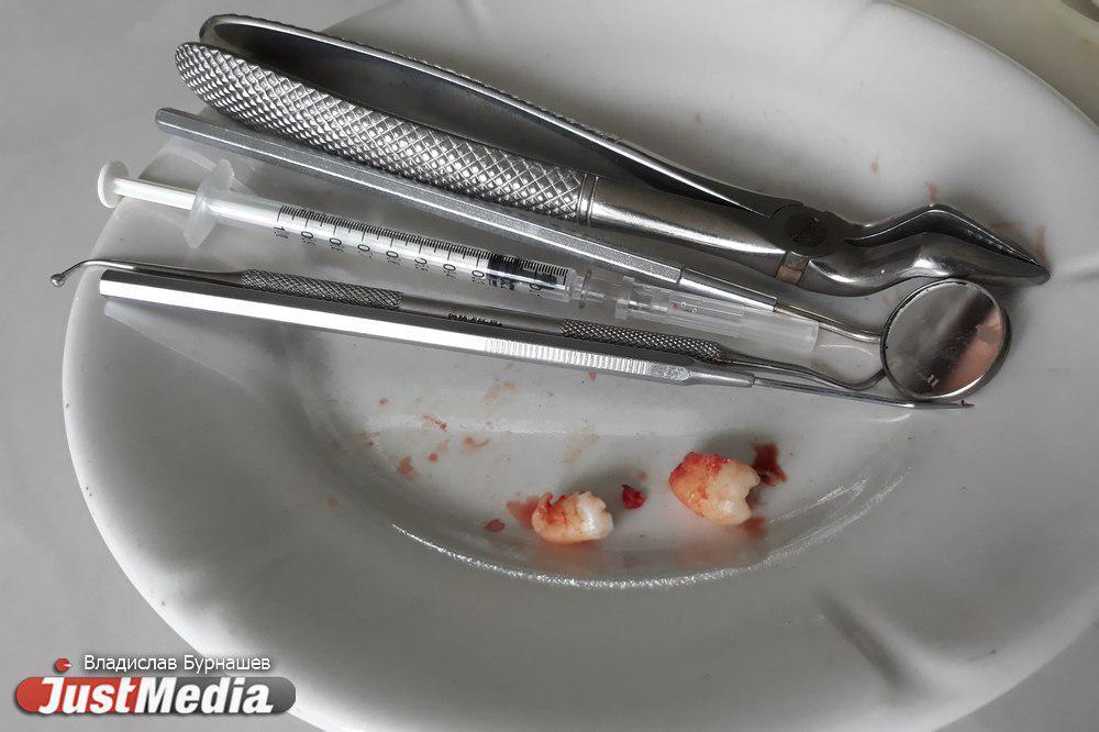 В Реже в стоматологии местной жительнице во время удаления зуба сломали челюсть - Фото 1