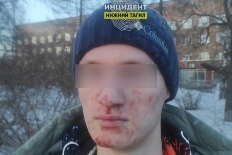 В Нижнем Тагиле южане избили 17-летнего подростка за отказ дать закурить - Фото 1