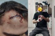 В Каменске-Уральском незнакомец напал на пару с ножом. Парень получил травмы