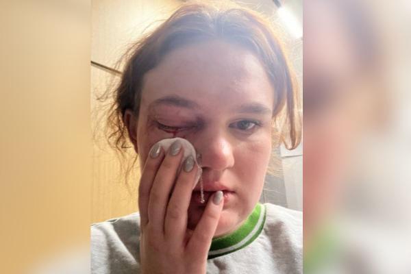 Студент из Ирака избил и пытался выдавить глаз экс-возлюбленной из Екатеринбурга - Фото 1