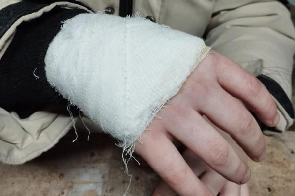 В поселке Малышева учительница истыкала циркулем ладонь второклассника - Фото 1