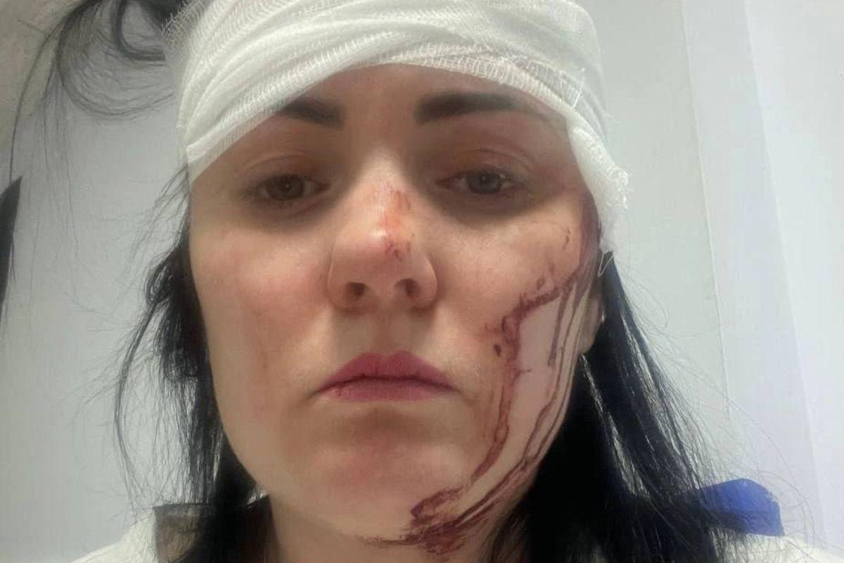 Прокуратура Екатеринбурга проверит факт травмирования женщины штукатуркой - Фото 1