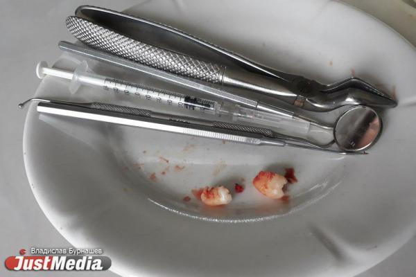 Электронная сигарета взорвалась во рту у школьника из Уфы - Фото 1