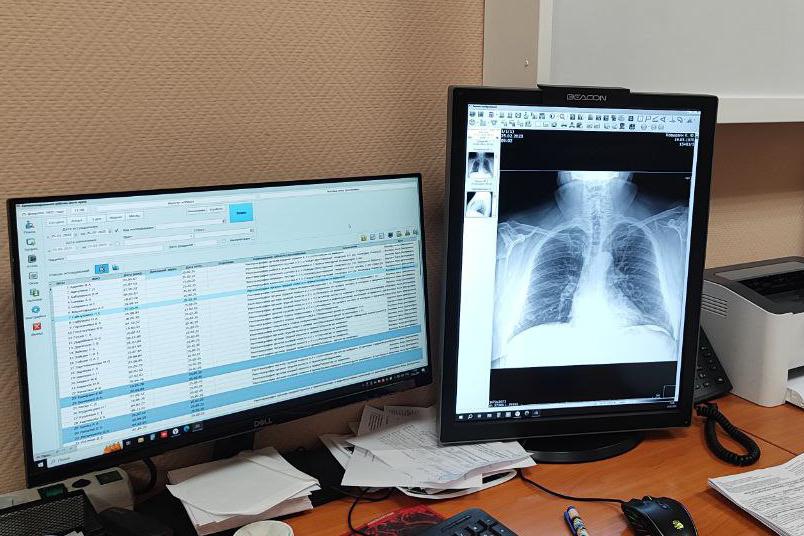 Медики Екатеринбурга рассказали о том, как безопасно выявить туберкулез - Фото 1