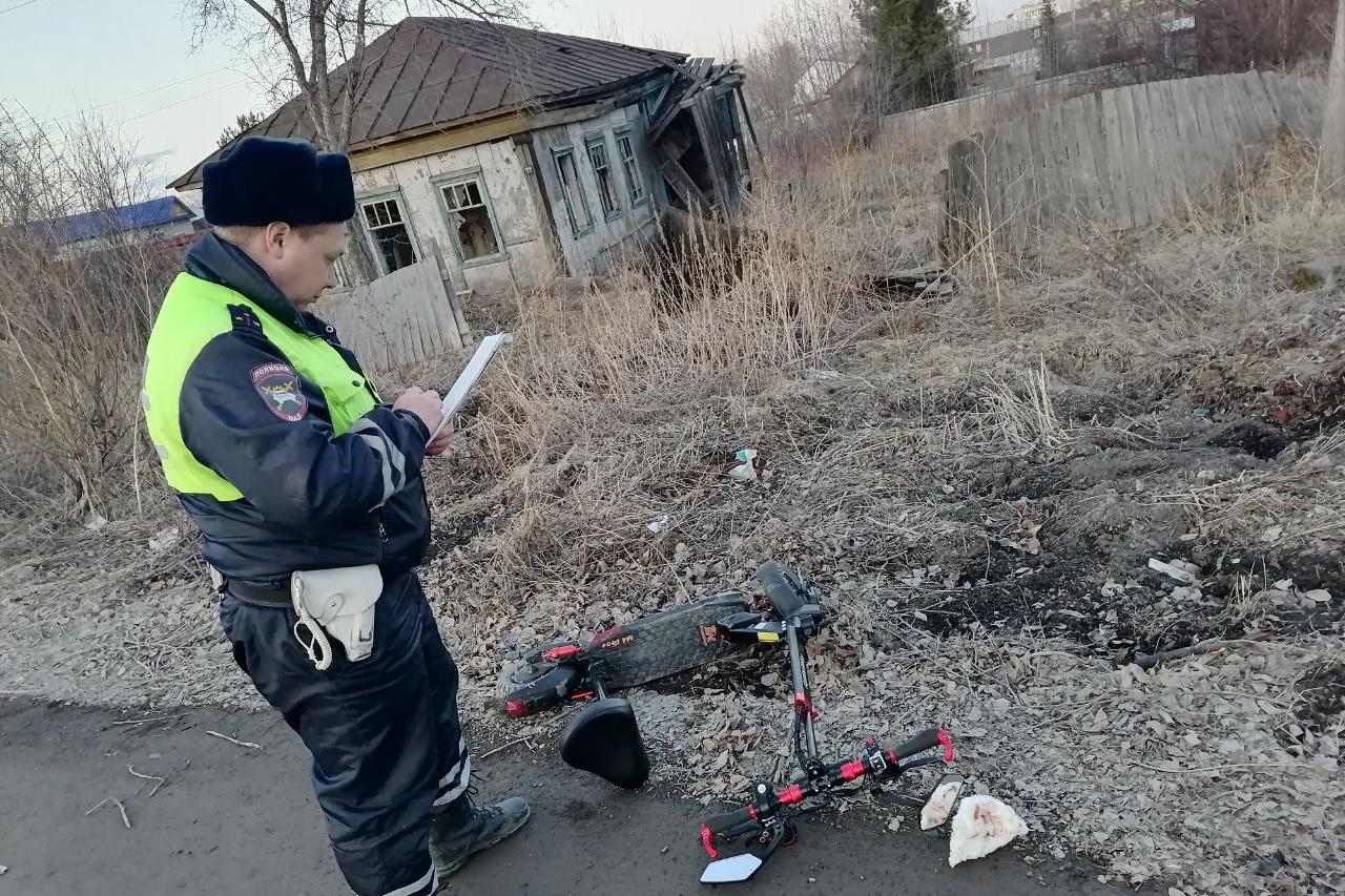 В Серове пьяный водитель электросамоката сломал себе нос - Фото 1