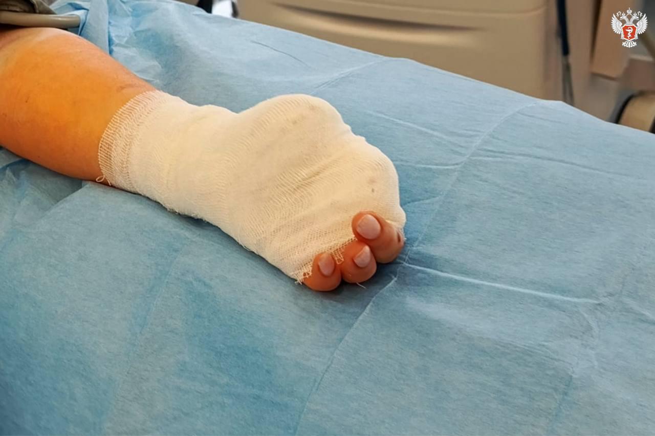 В Югре девушка лишилась пальцев на руке из-за зарядки телефона в ванной - Фото 1