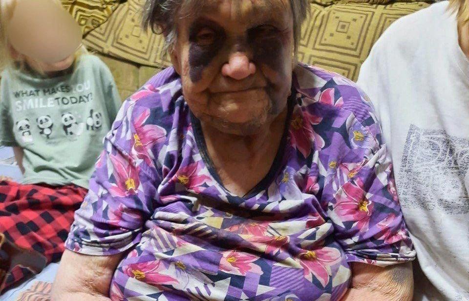 Глава СКР взял на контроль дело о смерти 90-летней пенсионерки, которую жестоко избили дома - Фото 1