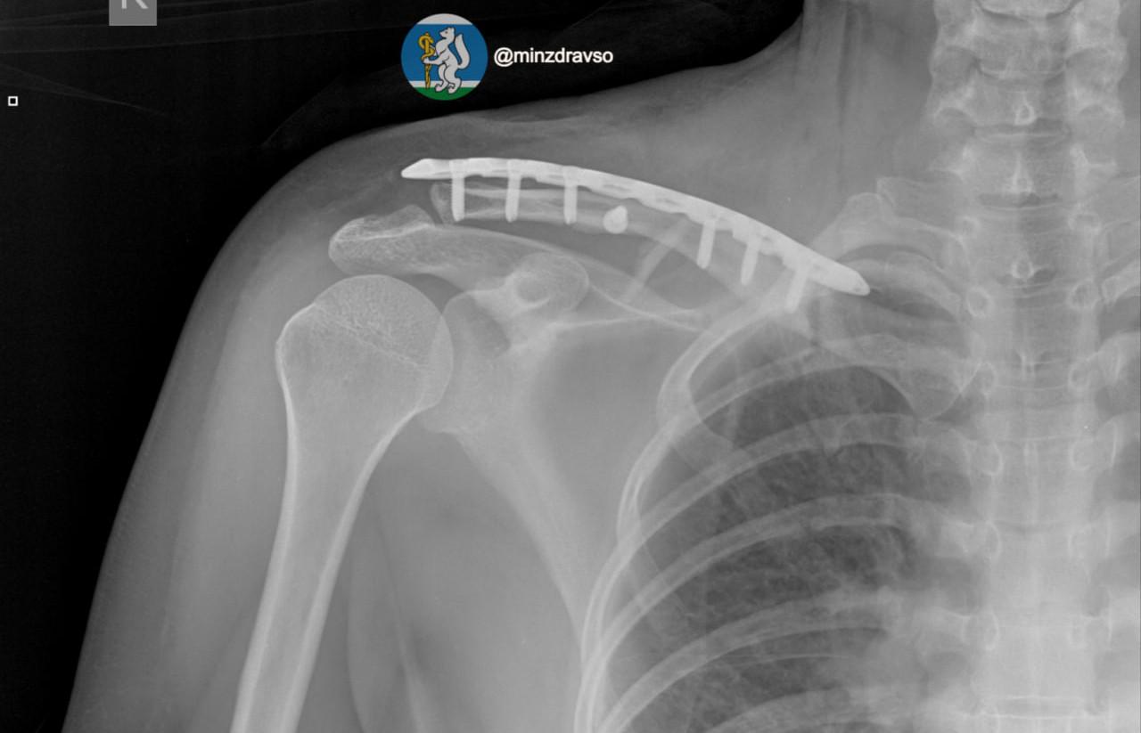 Врачи вернули к жизни екатеринбурженку, которую переехала машина - Фото 1