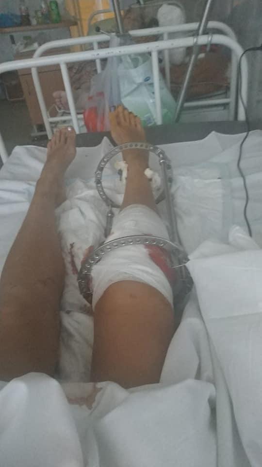 В Екатеринбурге цыган на чужой машине сбил девушку-хореографа и через родных начал ей угрожать - Фото 3