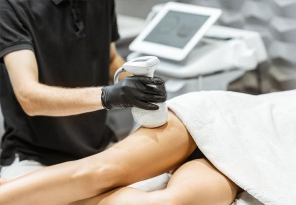 Липосакция живота на аппарате Ulfit - Фото 2