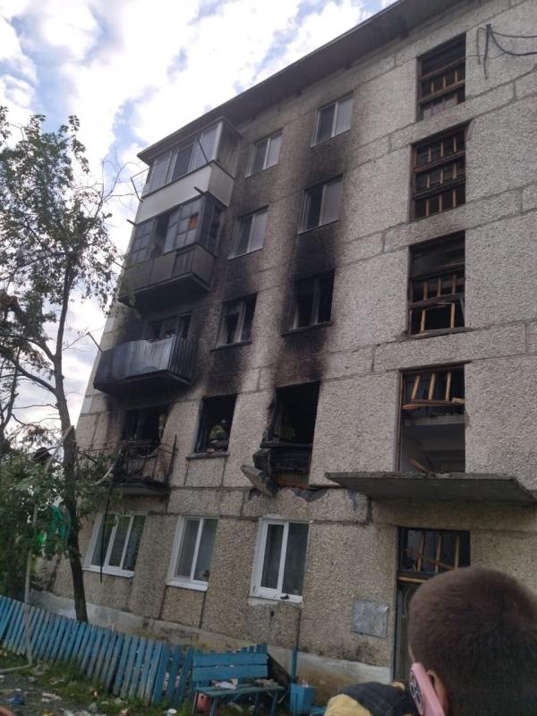 Медики рассказали о состоянии пострадавших во время ЧП в Ивделе - Фото 2