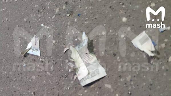 В Красногорске 9-летний мальчик поднял деньги с земли и лишился нескольких пальцев на руке - Фото 3