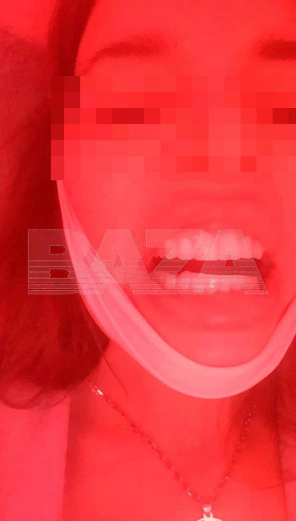 Екатеринбурженка утверждает, что заплатила почти 2 млн рублей за зубы и теперь не может есть и говорить - Фото 2