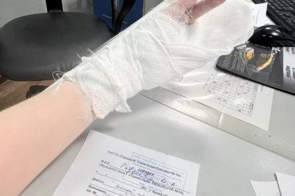 Жительница Екатеринбурга сломала руку во время заезда в картинг-центре и осталась без работы - Фото 4