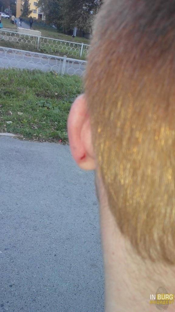 В Екатеринбурге побили несовершеннолетнего. В деле разбирается полиция - Фото 2